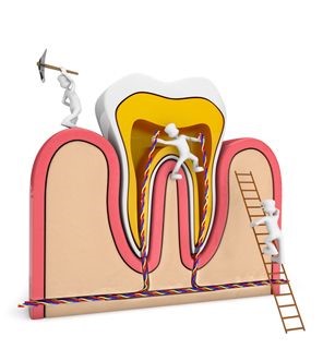 Alanya-Root-Canal-Treatment