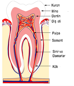 Alanya-Root-Canal-Treatment