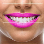 Alanya-Personel-Smile-Design