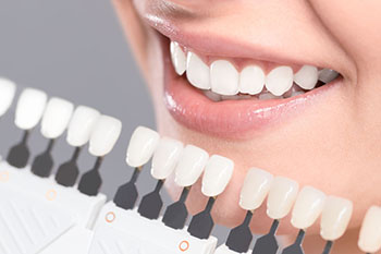 Alanya-lamina-dental-treatment